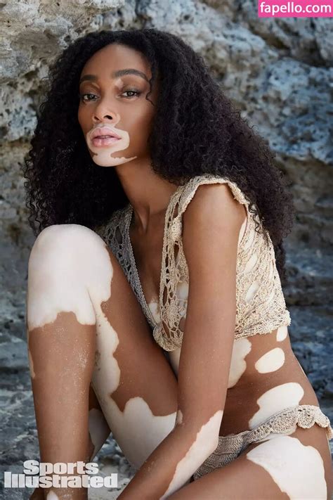 Winnie Harlow Winnieharlow Nude Leaked Photo Fapello