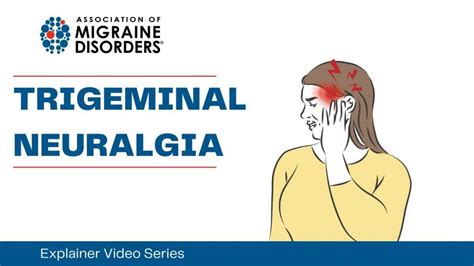 Chapter 2 Episode 8 What Is Trigeminal Neuralgia Association Of Migraine Disorders