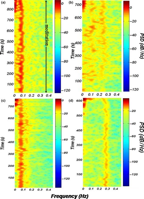 Representative Spectrograms Of R‐r Interval Series Of A Subject From Download Scientific