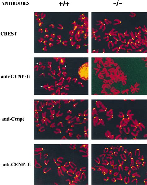 Immunostaining Of Centromere Proteins Yellow Signals In R1 And