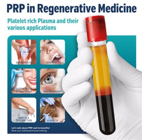 Platelet Rich Plasma Prp Injections Purpose Effectiveness