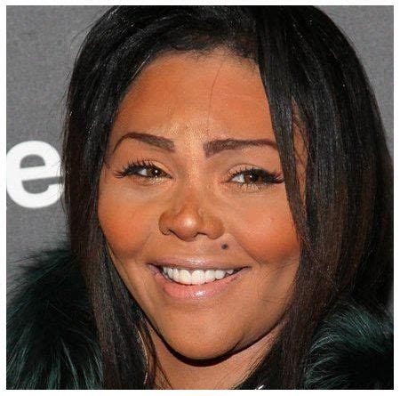 Plastic Surgery Before And After Rhinoplasty Gone Wrong Celebrity