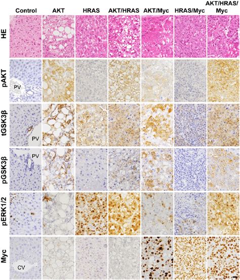 Pathologic Features And Changes In Relevant Signaling Molecules Of