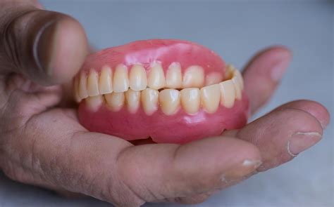 Functional Advantages Of Dental Implants Warm Smiles Dental