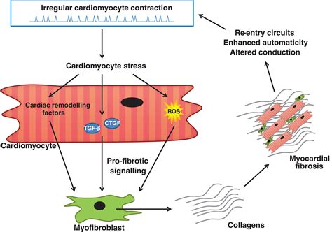 The Vicious Cycle Of Arrhythmia And Myocardial Fibrosis Piek 2019