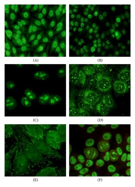 Indirect Immunofluorescence Assay Graphs A Antinuclear Antibody