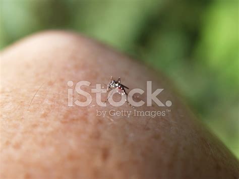 Mosquito Bite Stock Photo | Royalty-Free | FreeImages