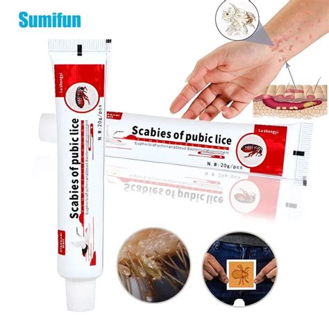 Pcs G Pubic Lice Removal Ointment Treat Scabies Mite Psoriasis