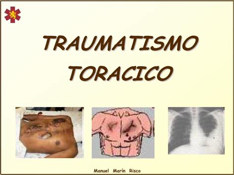 PDF TRAUMATISMO TORACICO Reanimovil Comreanimovil Media