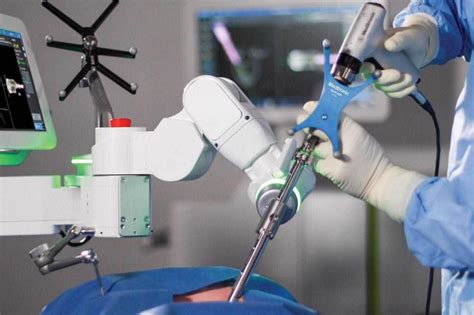 Spine Surgery Robots Market Latest Future Scope