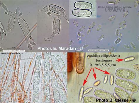 Myco Microscopie Ascospores De Sarcoscypha Austriaca D Ghyselinck