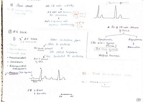 Solution Ecg Ekg Arrythmias Studypool