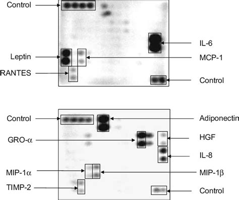 Cytokine Antibody Arrays Membranes Were Used To Detect Adipokines