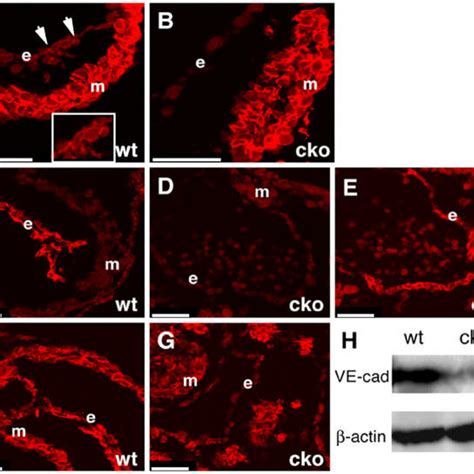 Cellular Localization Of Cadherins In Endothelial Cells Double