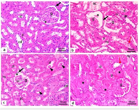 Photomicrographs of renal cortex of the control and diabetic untreated ...