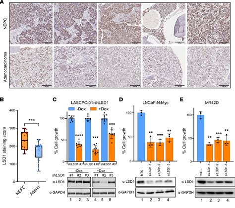 Figure 1 From LSD1 Promotes Prostate Cancer Reprogramming By Repressing