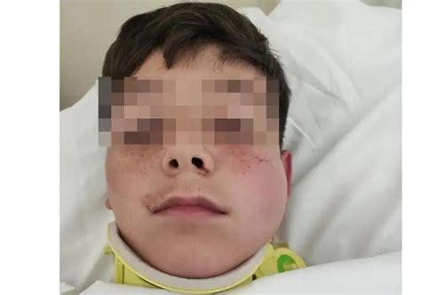 Un hombre noquea a un niño de 12 años en Estepona porque le molestaba