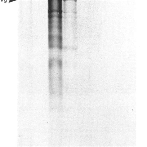 Sds1o Polyacrylamide Gel Electrophoresis Of Translation Products