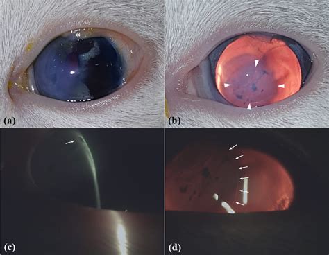 Figure From Bilateral Anterior Segment Dysgenesis With The Presumed