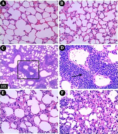 Figure Presents The Histological Examination Of Lung Sections From