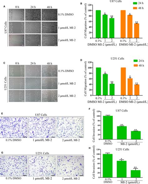 Mi‐2 Inhibits The Migration And Invasion Of Gbm Cells A And C The