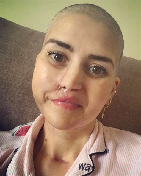 Renascer Depois Do Cancro Luciana Venceu Um Tumor Muito Raro Que Lhe