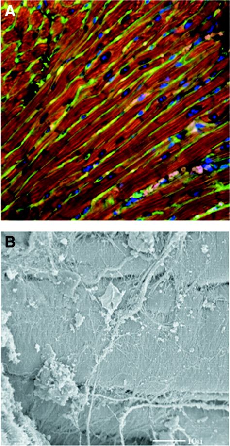 Cardiac Fibroblast Circulation Research