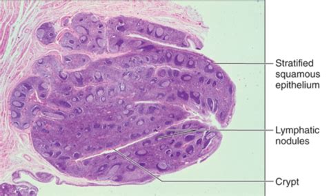 Bio 228 Lymphatic System Flashcards Quizlet