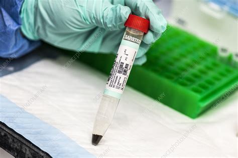 DNA library preparation reagent - Stock Image - C057/0268 - Science ...