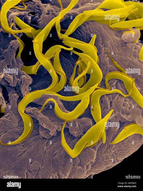 Trypanosome Trypomastigote Trypanosoma Sp Coloured Scanning