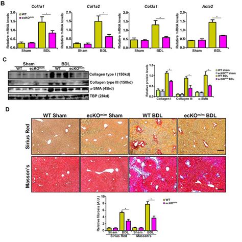 Endothelial MKL1 Deficiency Attenuates CCl 4 Induced Liver Fibrosis In