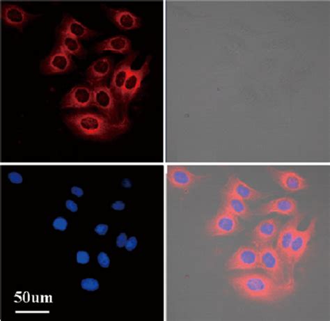 Confocal Laser Scanning Microscopy Clsm Image Of Mcf Cells After