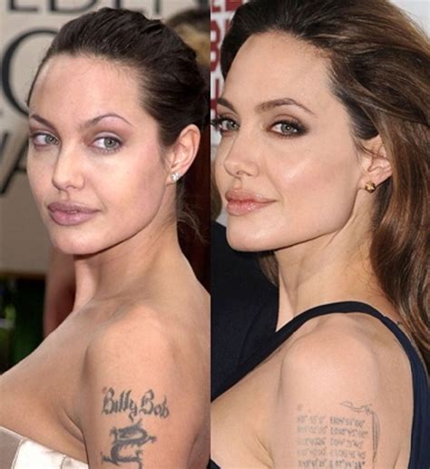 Angelina Jolie Jaw Surgery Google Search Angelina Jolie Plastic