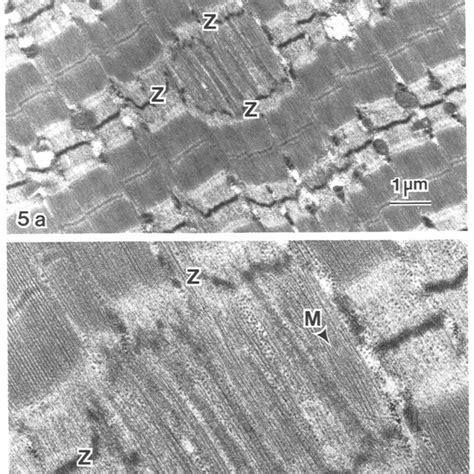 Electron Micrograph Of Longitudinally Sectioned Muscle Fibre After