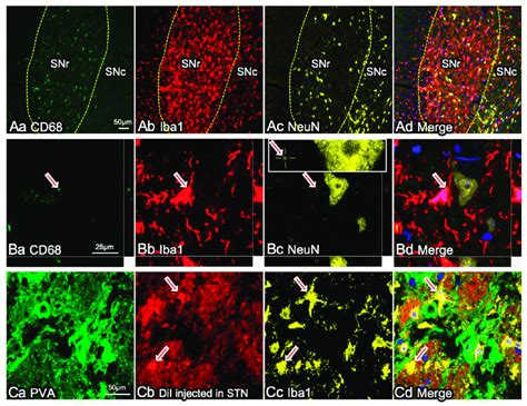 Microglial Activation Is More Pronounced In Snr And Gpi Than In Snc