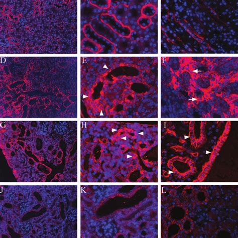 The Increased Cytosolic And Nuclear Catenin In The Tubular Epithelial Download Scientific