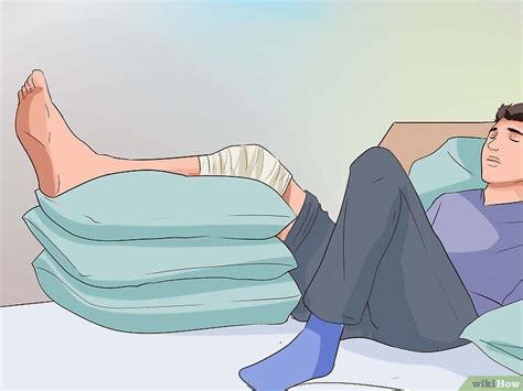 How To Treat A Knee Sprain 13 Steps With Pictures Sprain Knee