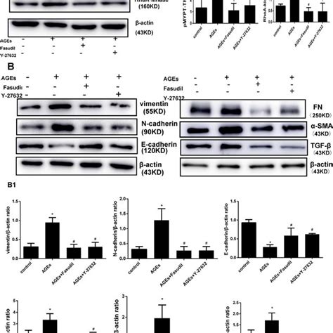 Fasudil And Y 27632 Inhibit Age Induced Rhoa Signaling And Emt A