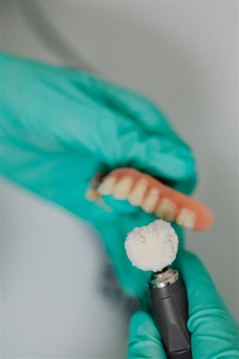 Mitos Sobre Implantes Dentales Cl Nica Dental Ja N