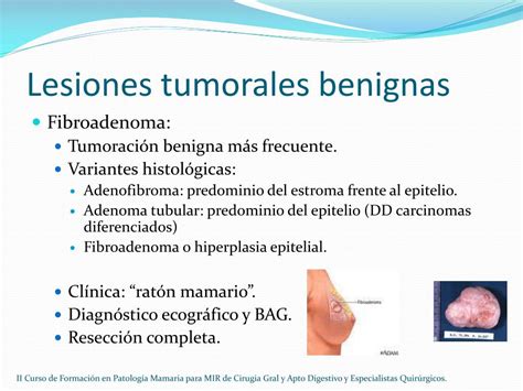 Ppt Patolog A Benigna De La Mama Powerpoint Presentation Free