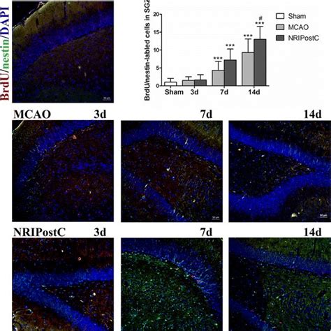 Representative Photomicrographs Of Brdu Nestin Red Green Cells From