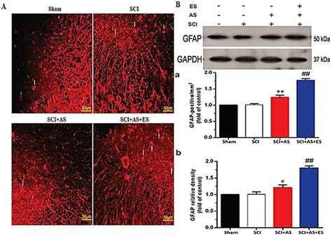 Glial Fibrillary Acidic Protein Gfap Expression After Two Weeks In