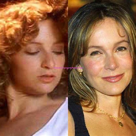 Jennifer Gray Before And After Nose Surgery Nakpic Store