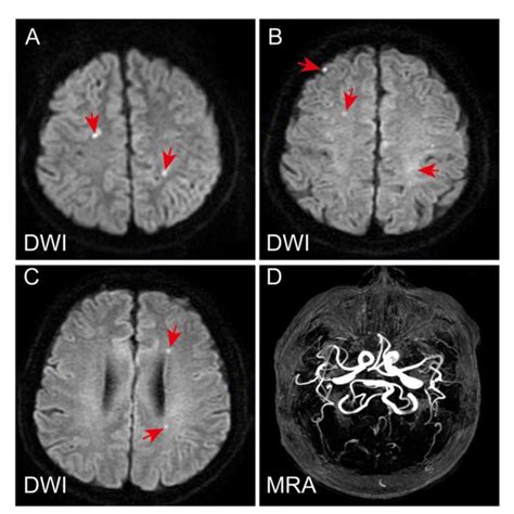 Figure Magnetic Resonance Imaging And Magnetic Resonance Angiography Of