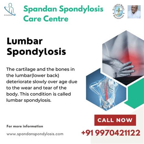 Lumbar Spondylosis Treatment at Rs 3000/day in Bengaluru | ID ...