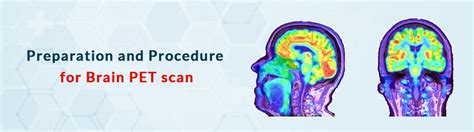 Brain PET Scan: Procedure, Requirement and Precautions