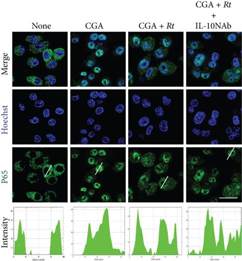 Effects of Rt on the NF κB activation pathways in CGA stimulated