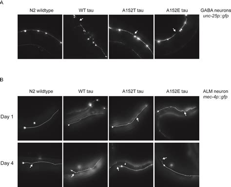 Tau MAPT Disease Associated Variant A152T Alters Tau Function And