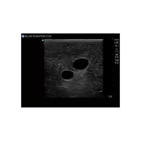 Gen Ii Central Line And Regional Anaesthesia Ultrasound Training Model