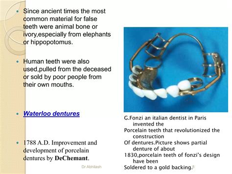 Arrangement of teeth in complete denture | PPTX